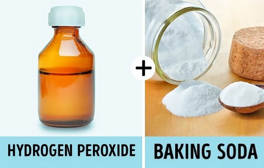 Dùng baking soda và hydrogen peroxide để loại trừ mảng bám