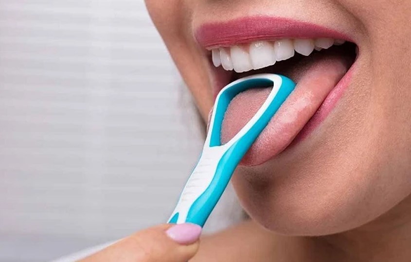 Không vệ sinh lưỡi sẽ tạo ra các mảng bám làm răng ố vàng