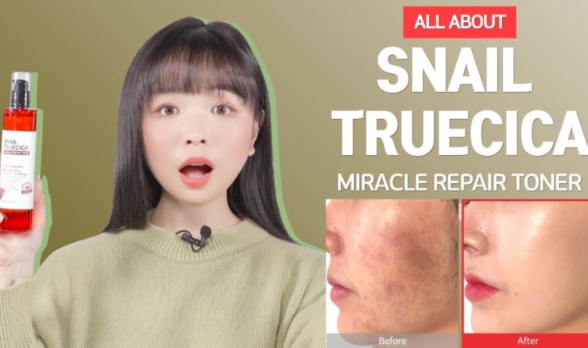 Cải thiện hiểu quả vết thâm mụn trên da và ngăn ngừa hình thành trở lại