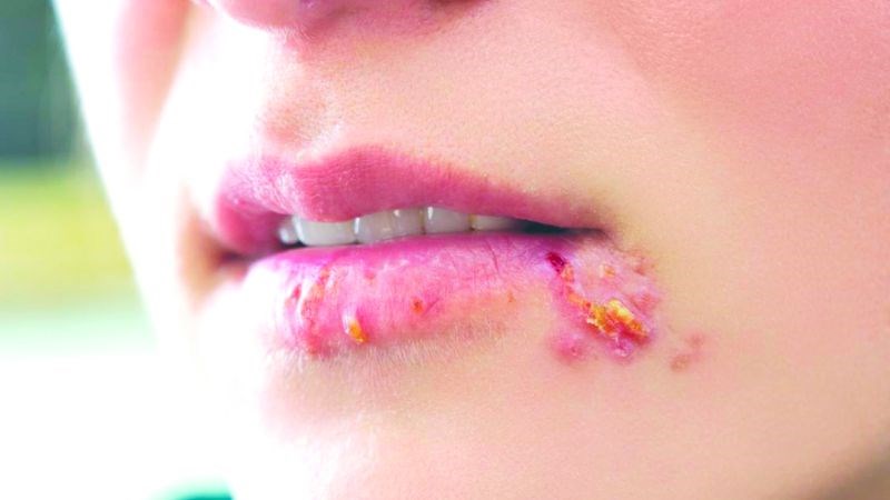 STIs lây truyền tư người sang người qua đường tình dục