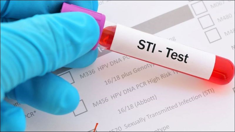 Thực hiện xét nghiệm STI nếu có nguy cơ mắc bệnh lây qua đường tình dục