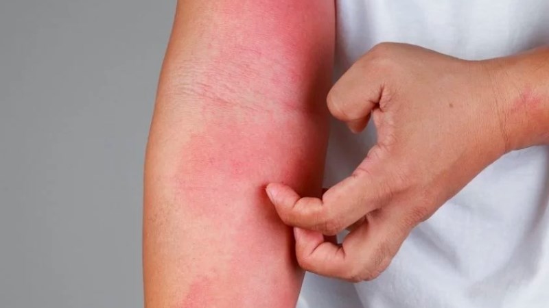 Cam thảo đất có thể gây dị ứng ở một số người 