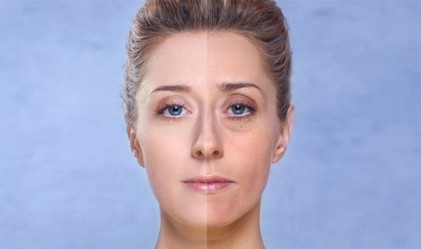 Dành cho da bị xỉn màu, thiếu độ ẩm cần thiết, khô ráp