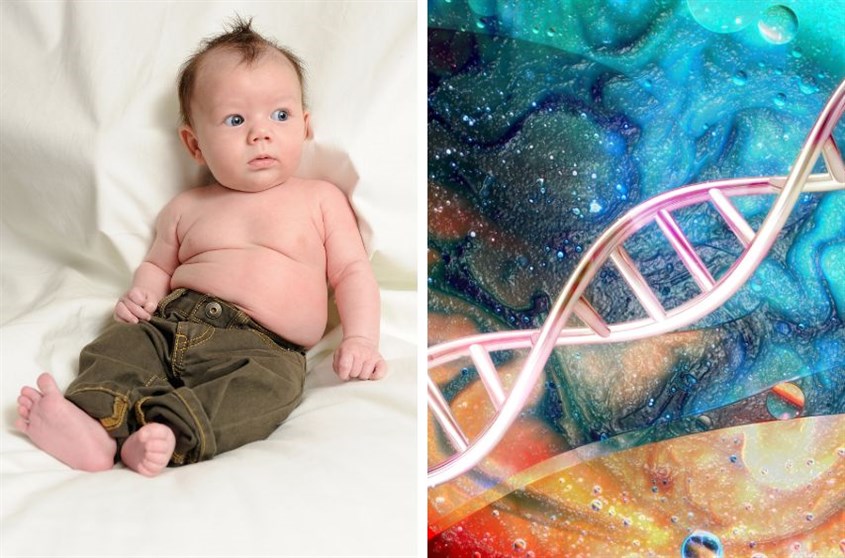 Một số nguyên nhân gây ra tình trạng vảy nến ở trẻ Bé bị bệnh vảy nến