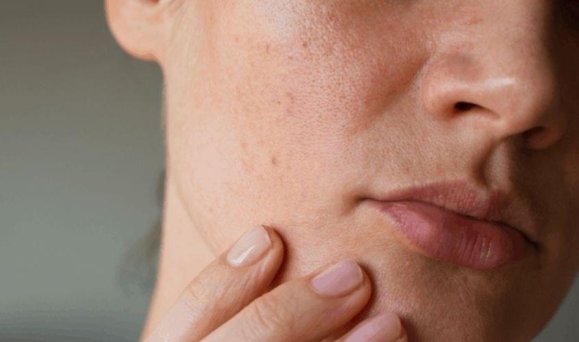 Phù hợp với mọi loại da, kể cả da khô Phù hợp với mọi loại da, kể cả da khô