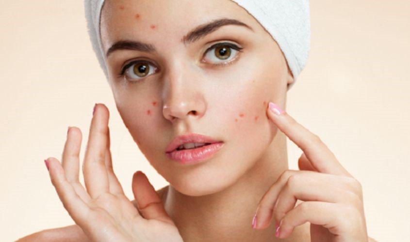 Nên ngưng sử dụng ngay khi xảy ra kích ứng Nên ngưng sử dụng ngay khi xảy ra kích ứng