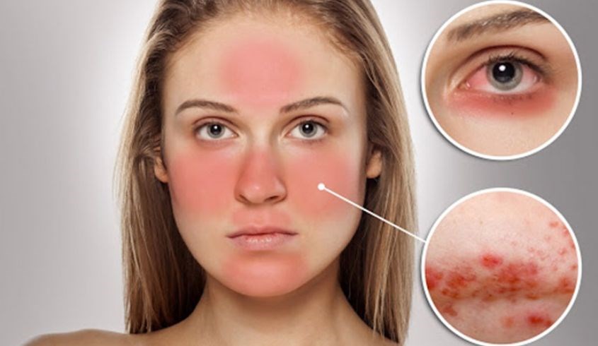 Chọn mỹ phẩm có thành phần lành tính giúp làn da tránh việc bị kích ứng