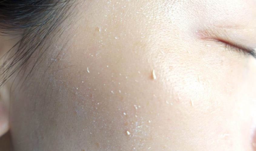 Kem dưỡng bị vón cục do một số nguyên do nhất định