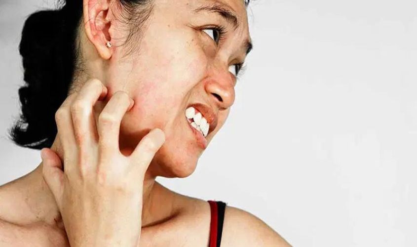 Da trở nên ngứa rát, khó chịu