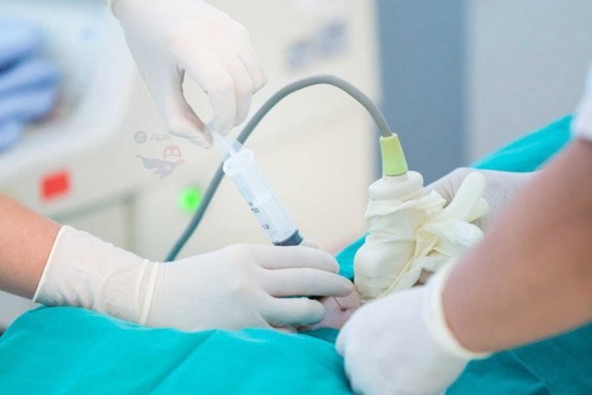 Chọc ối là việc cần thiết để chẩn đoán các nguy cơ dị tật thai kỳ