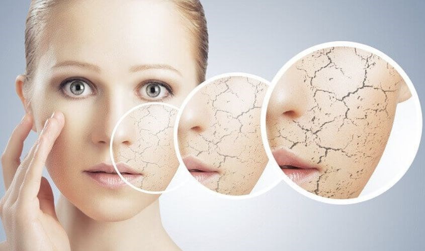 Tình trạng da khô dưới góc độ y học