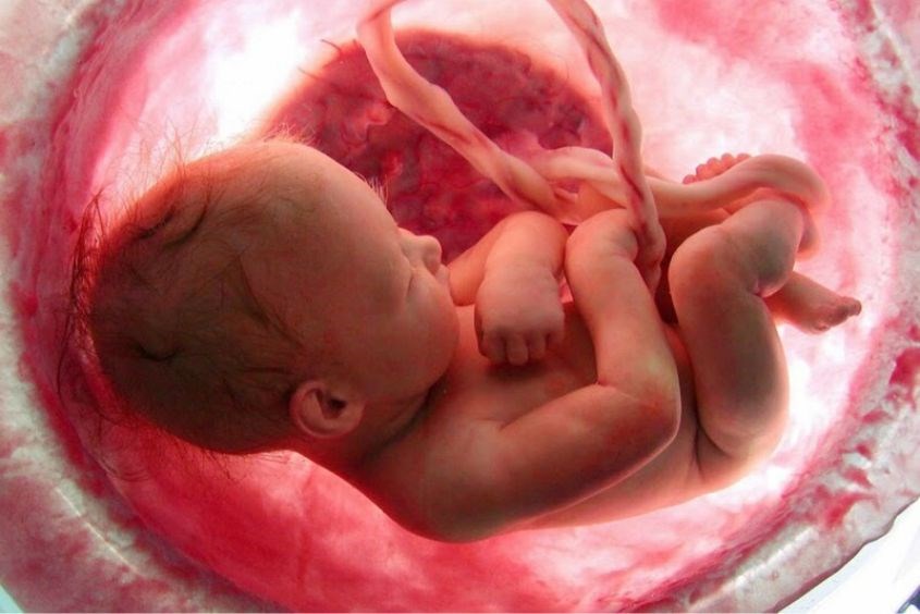 Siêu âm Doppler thai giúp phát triển dị tật tim thai