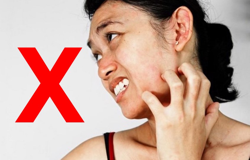 Tránh gãi, chà xát da mặt