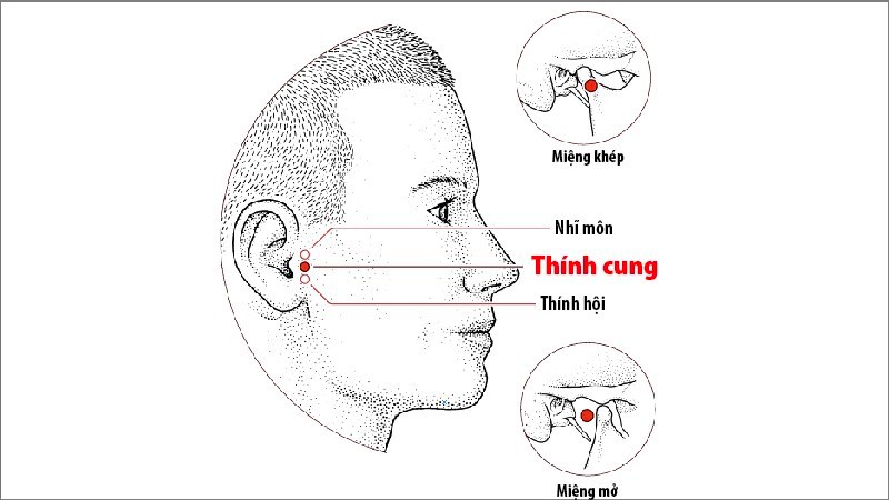 5 cách bấm huyệt chữa ù tai hiệu quả có thể bạn chưa biết