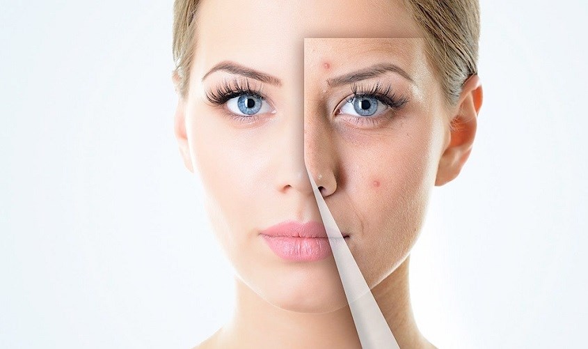 Bạn cần cân nhắc trước khi sử dụng để tránh tình trạng da bị kích ứng