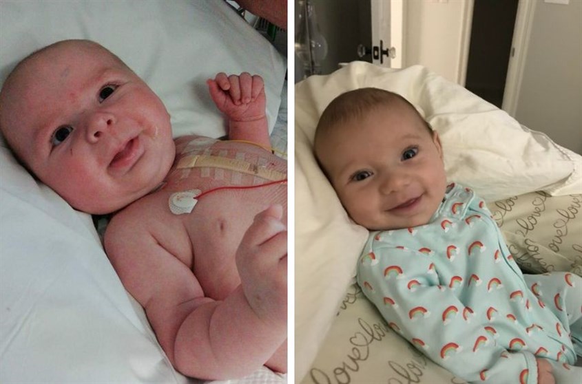 Dị tật tim bẩm sinh tím và dị tật tim bẩm sinh không tím Bệnh tim bẩm sinh ở trẻ