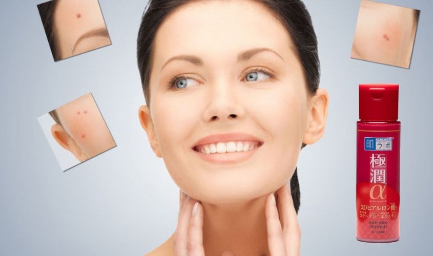 Toner Hada Labo còn giúp cấp ẩm, dưỡng sáng hay hỗ trợ trị mụn rất hiệu quả