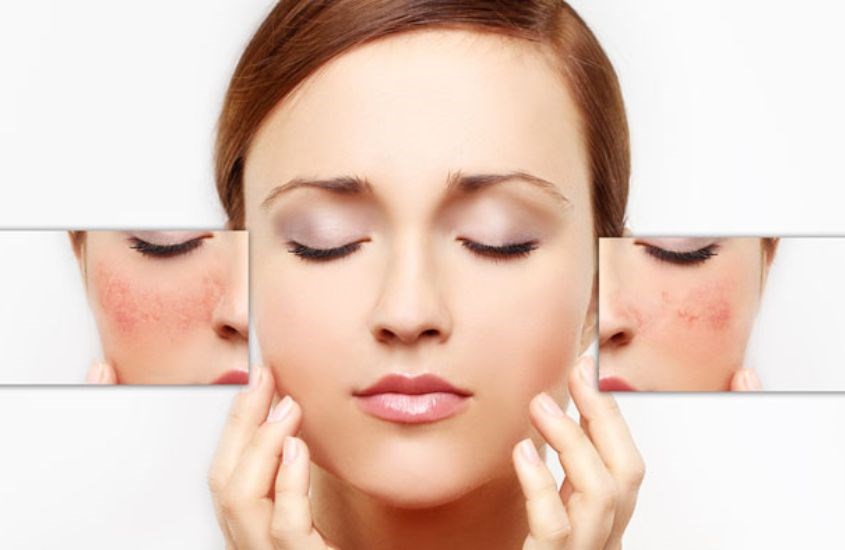 Máy tẩy tết bào chết giúp mạch máu dưới da mặt lưu thông dễ dàng