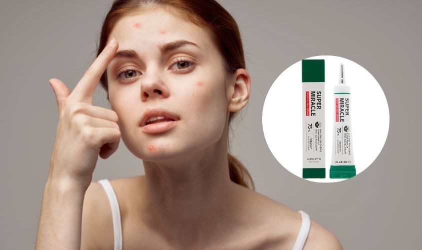 Kem chấm mụn Some By Mi giúp xẹp nhanh các nốt mụn đỏ