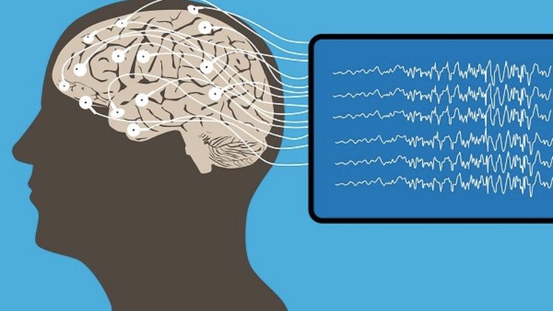 Điện não đồ đo hoạt động điện trong não