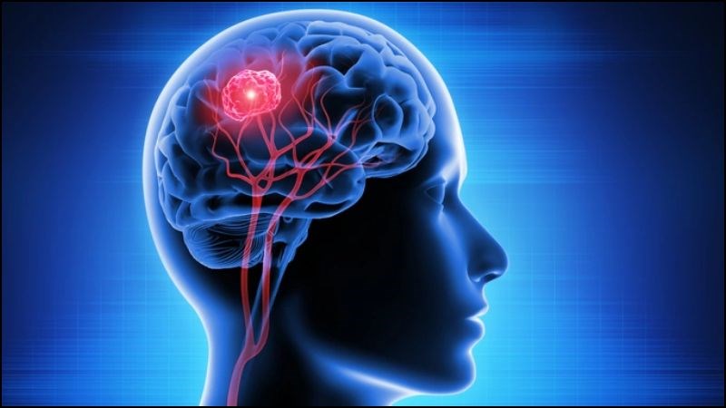 U não xảy ra gần khu vực tiền đình có thể gây rối loạn tiền đình