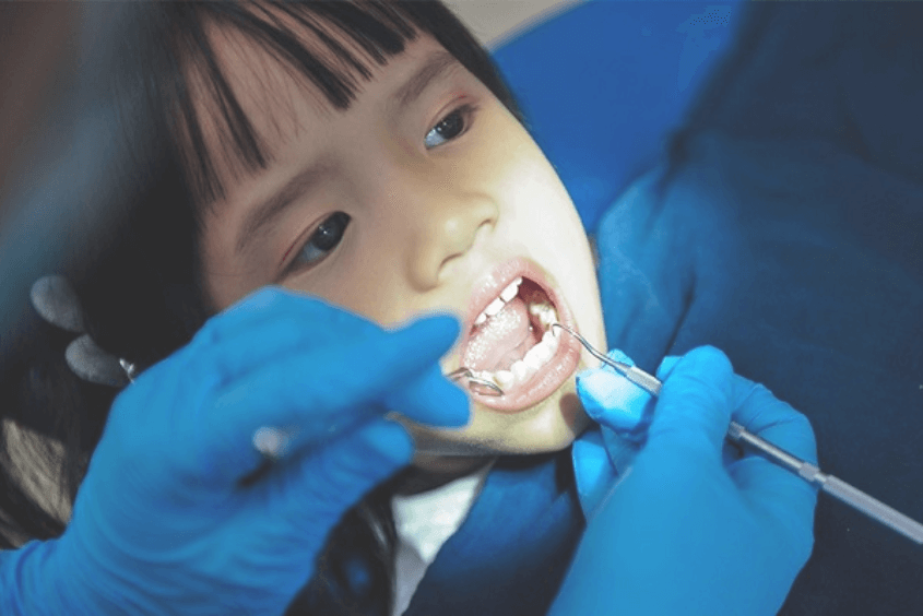 Lấy cao răng là cách phòng ngừa sâu răng cho bé hiệu quả Lấy cao răng là cách phòng ngừa sâu răng cho bé hiệu quả