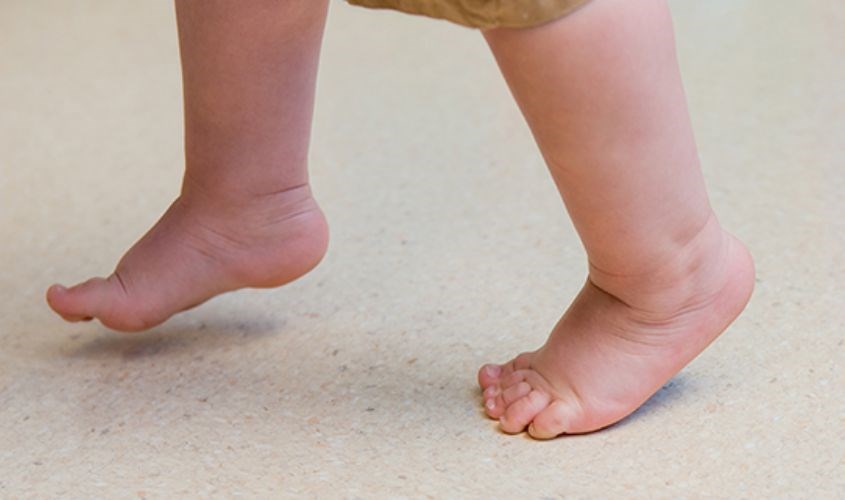 Trẻ đi nhón chân do nhiều nguyên nhân như gân gót chân ngắn, bệnh tự kỷ,... Trẻ đi nhón chân do nhiều nguyên nhân như gân gót chân ngắn, bệnh tự kỷ,...