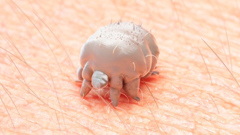 Nguyên nhân gây bệnh ghẻ