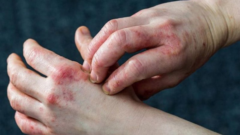 Khi nào gặp bác sĩ?