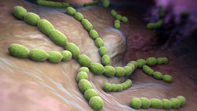Viêm họng do Streptococcus thường biểu hiện triệu chứng nặng nề