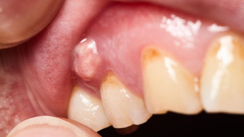 Răng đau ảnh hưởng nhiều cho cuộc sống và công việc