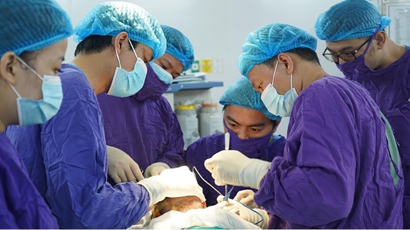 Phẫu thuật cắt bỏ tuyến nước bọt khi tình trạng chảy nước dãi nặng