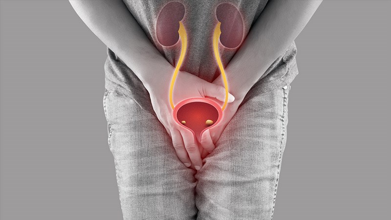 Sỏi niệu quản thường gây ra tình trạng són tiểu