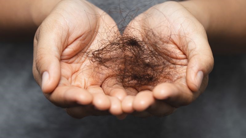 Rụng tóc có thể là dấu hiệu của hạ canxi huyết