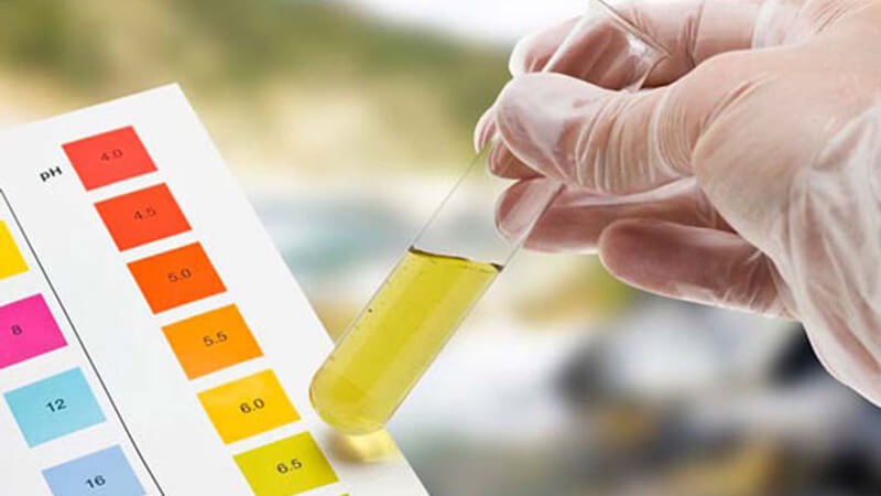 Xét nghiệm tổng phân tích nước tiểu để chẩn đoán ung thư bàng quang