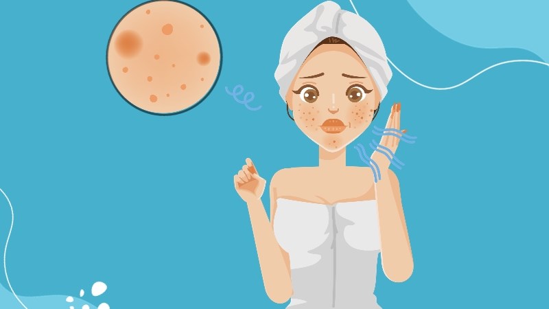 Làn da nhạy cảm thường dễ bị kích ứng gây viêm, đỏ, ngứa Làn da thường dễ bị kích ứng gây viêm, đỏ, ngứa