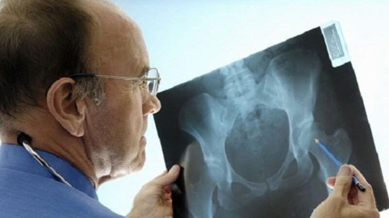 Cần theo dõi các vấn đề sau điều trị Cần theo dõi các vấn đề sau điều trị