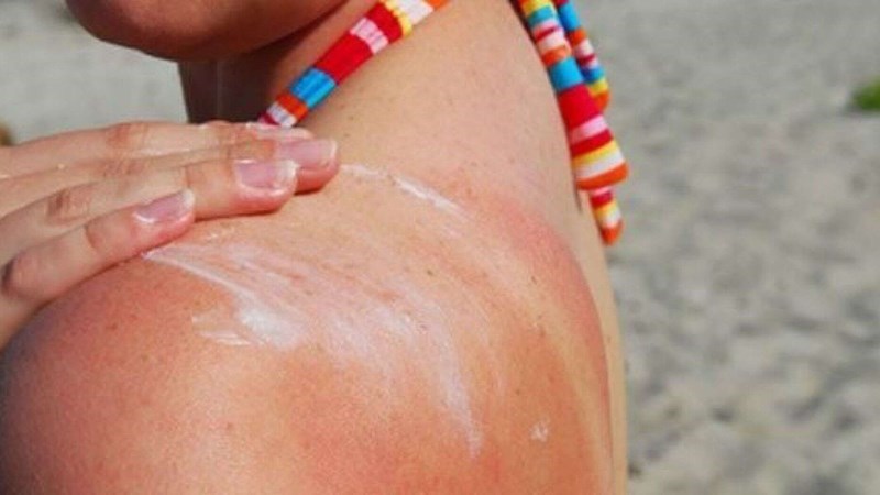 Tiếp xúc nhiều với ánh nắng mặt trời khiến da dễ bị tổn thương Tiếp xúc nhiều với ánh nắng mặt trời khiến da dễ bị tổn thương