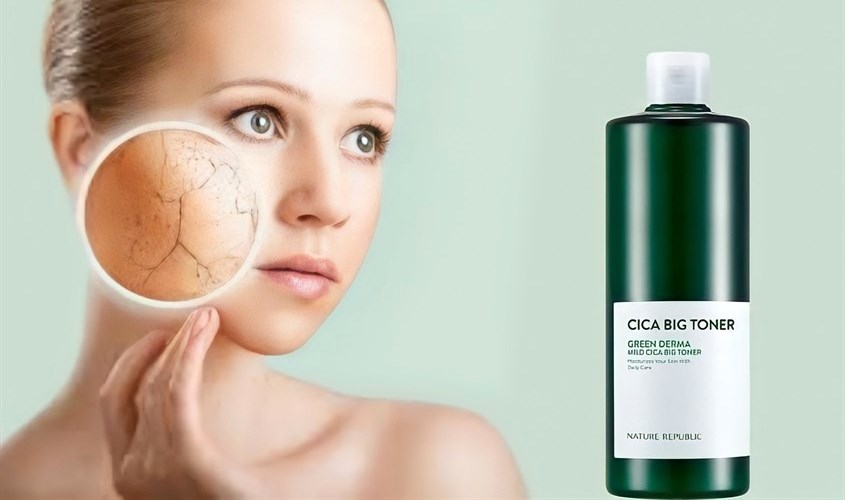 Toner cấp ẩm làm dịu da Nature Republic Green Derma Mild Cica chiết xuất Rau Má và Keo Ong 500 ml