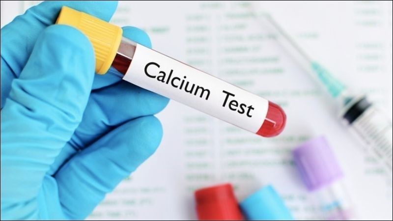 Bạn có thể làm xét nghiệm canxi trong máu để xác định nồng độ canxi trong máu