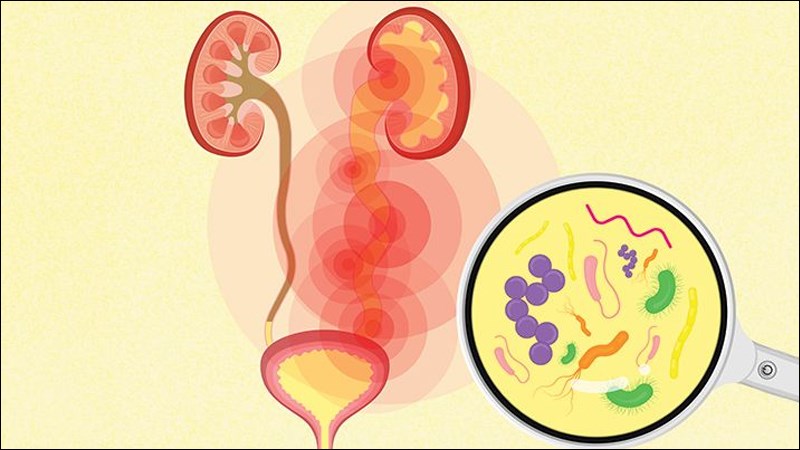 Nhiễm trùng đường tiết niệu có thể gây tiểu ra máu