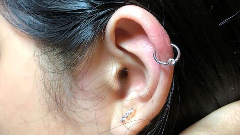 Tình trạng dị ứng sau khi bấm lỗ tai