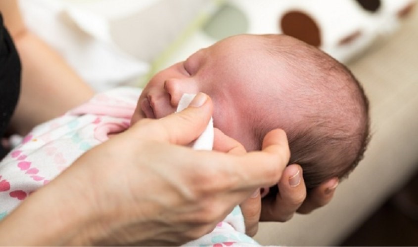 Dùng khăn thấm nước ấm rồi chườm lên vùng mắt bị lẹo của trẻ