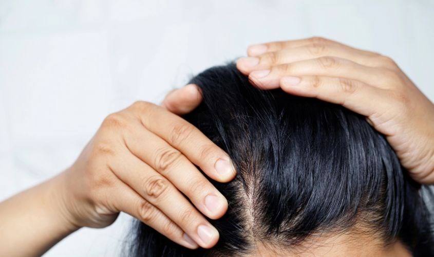 Dầu gội hết hạn có thể làm ảnh hưởng sức khỏe da đầu và tóc Dầu gội hết hạn có thể làm ảnh hưởng sức khỏe da đầu và tóc