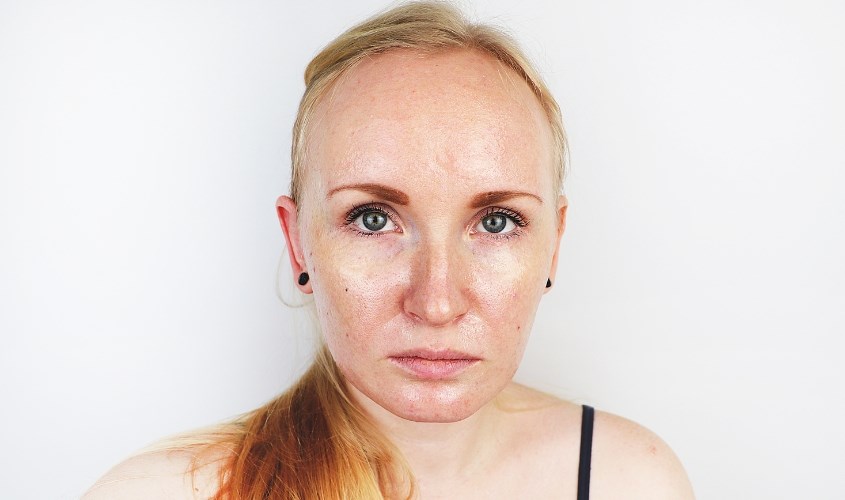 Nếu có da dầu thì bôi kem chống nắng dễ bị bóng mặt hơn