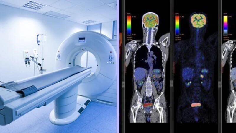 Các xét nghiệm thường được sử dụng để đánh giá vị trí cũng như mức độ xâm lấn của ung thư