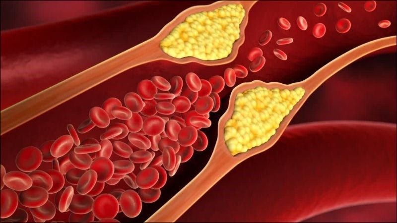 Ăn cà chua giúp giảm cholesterol xấu trong cơ thể