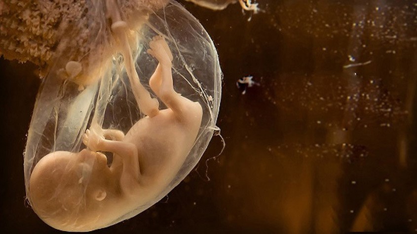 Thế nào là hiện tượng nước ối đục?