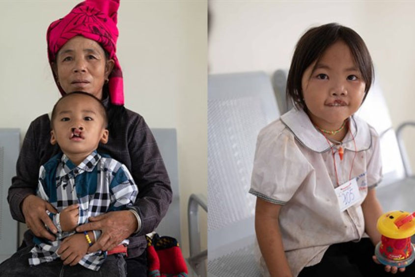 Quỹ Nụ Cười AVAKids đã đem đến cơ hội chữa lành cho nhiều em nhỏ kém may mắn tại Sơn La và TP.HCM