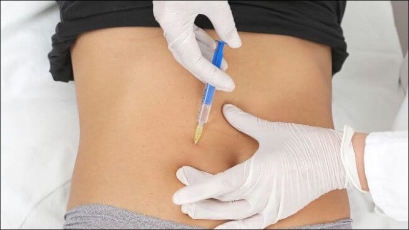 Tiêm botox giúp điều trị bàng quang tăng hoạt 